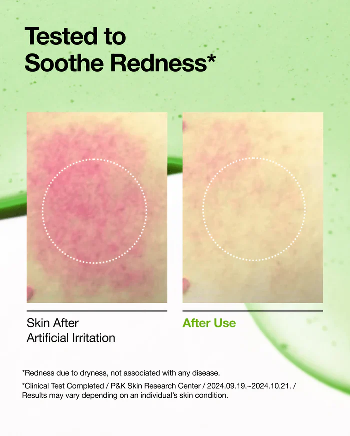 Anua Azelaic Acid 10 Hyaluron Redness Soothing Serum - Image 4