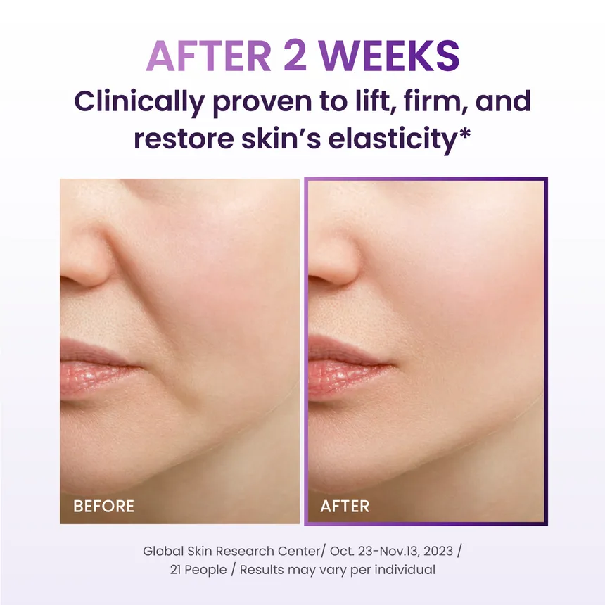 BIOHEAL BOH Probioderm 3D Lifting Travel Kit - Image 4