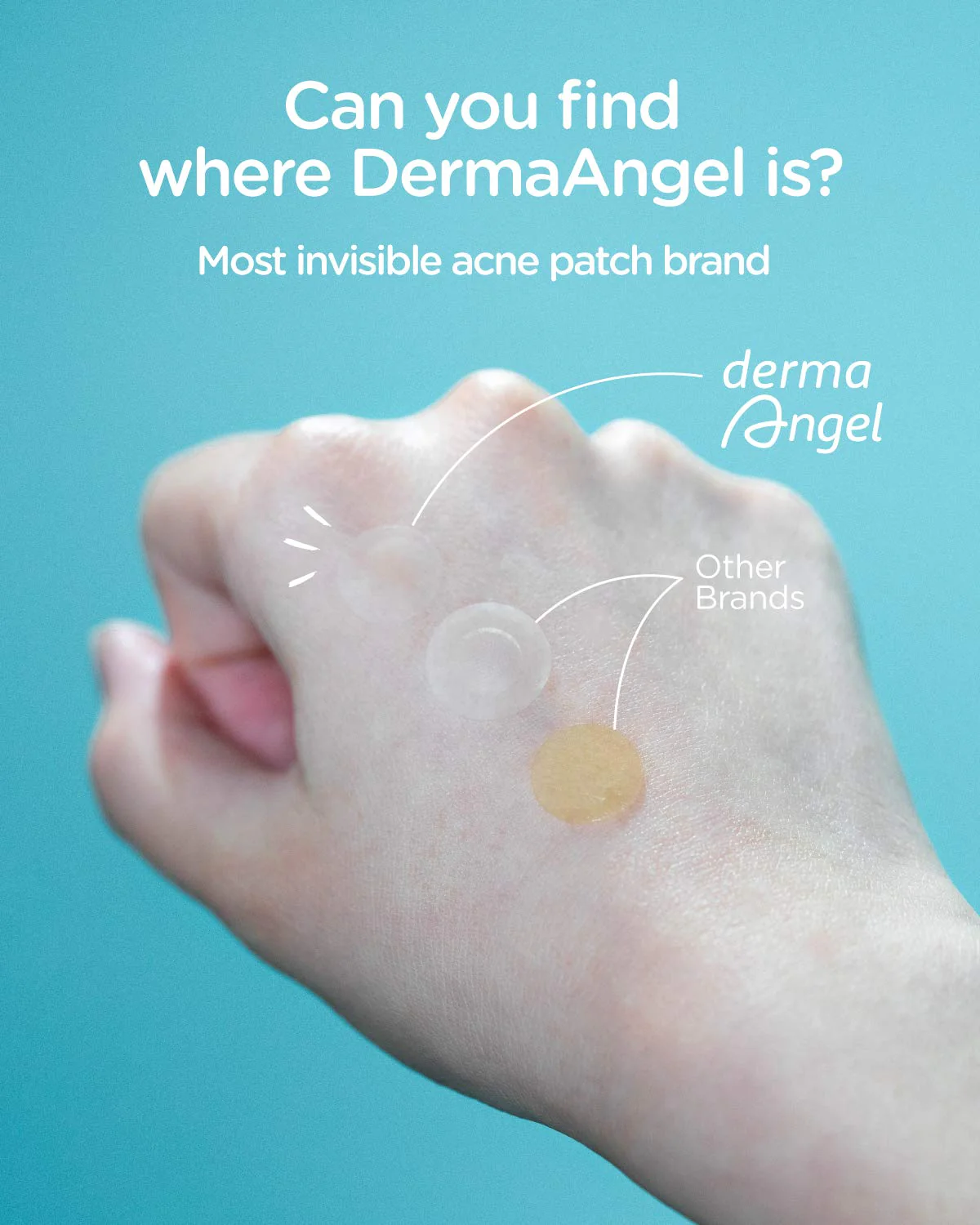 DermaAngel Ultra Invisible Acne Pimple Patch Value Pack - Image 2