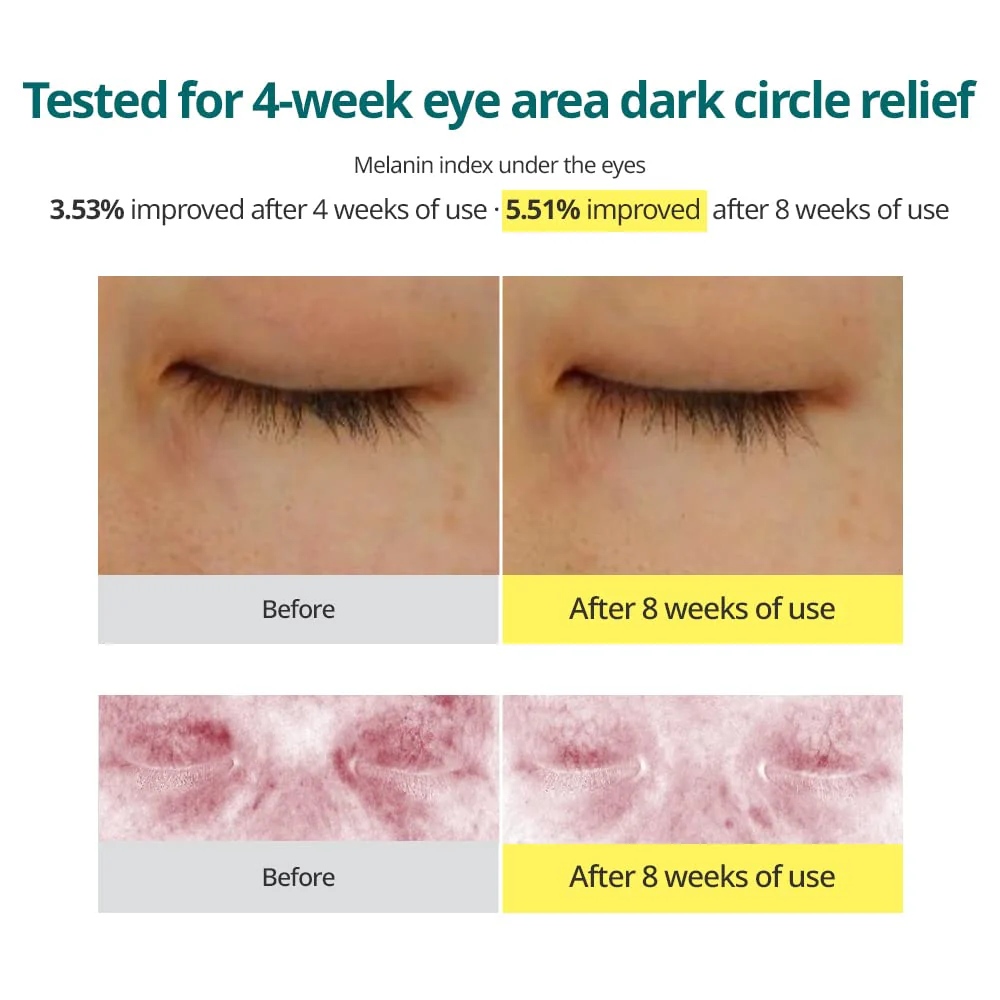 Goodal Green Tangerine Vitamin C Dark Circle Eye Cream - Image 4