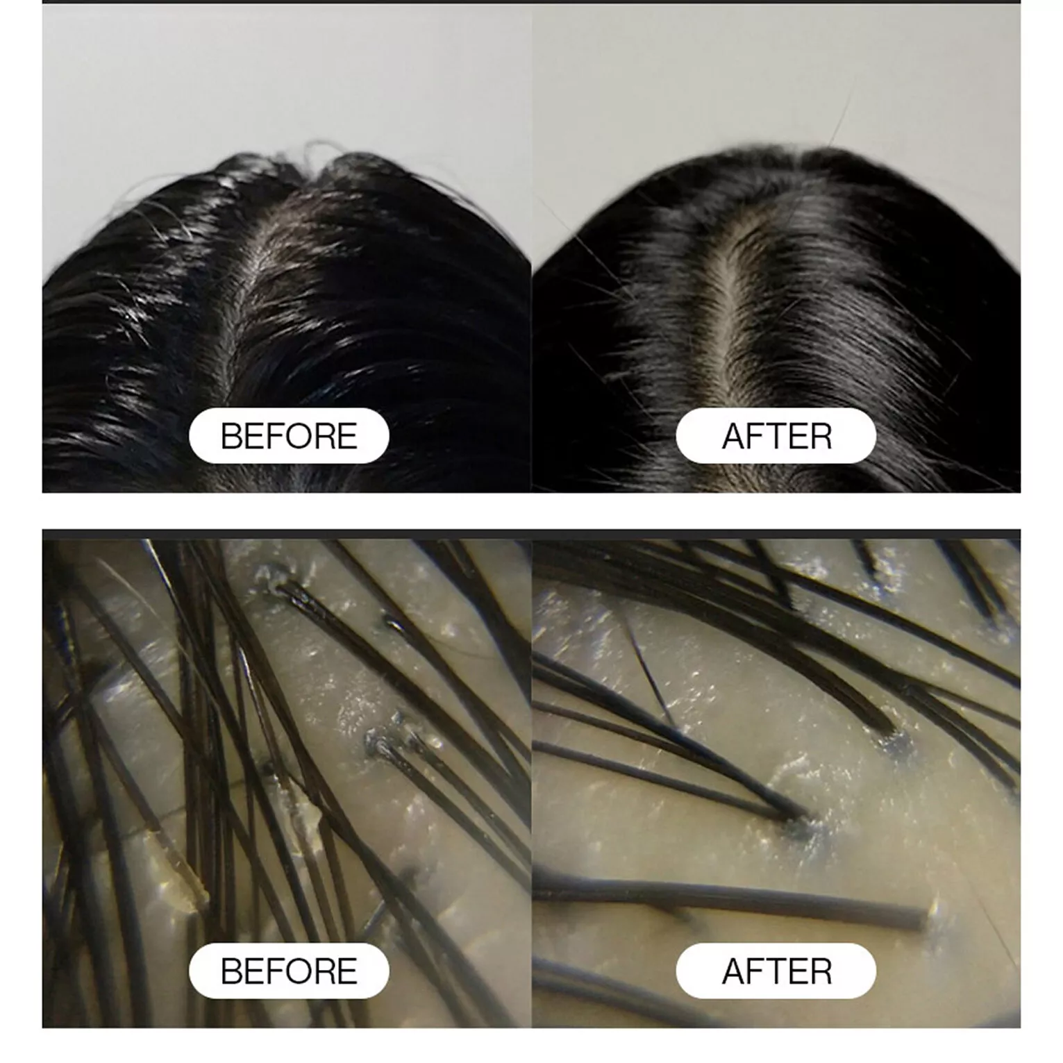 GROWUS Sea Salt Therapy Scalp Scaler - Image 4