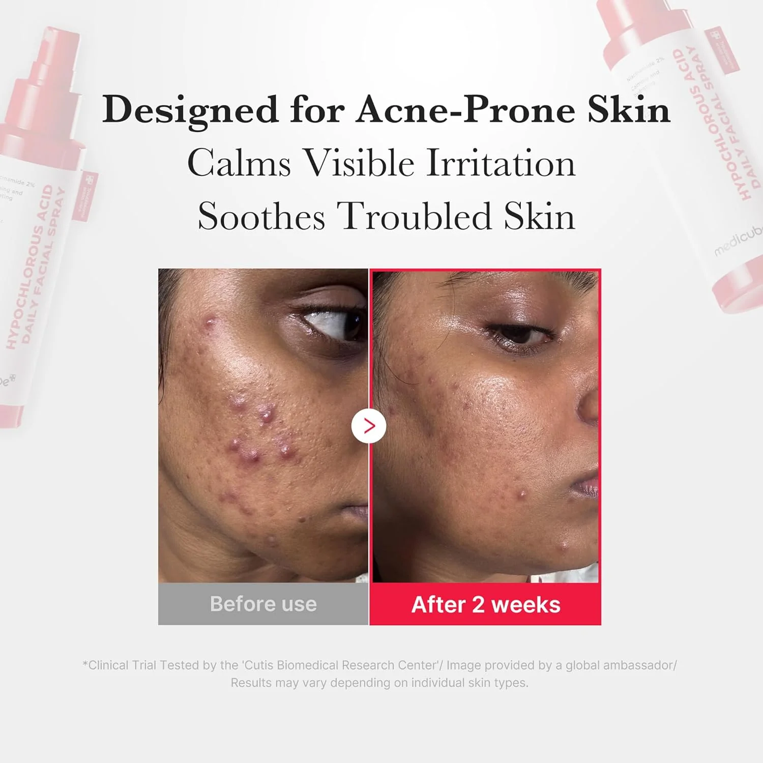 Medicube Hypochlorous Acid Daily Facial Spray - Image 5