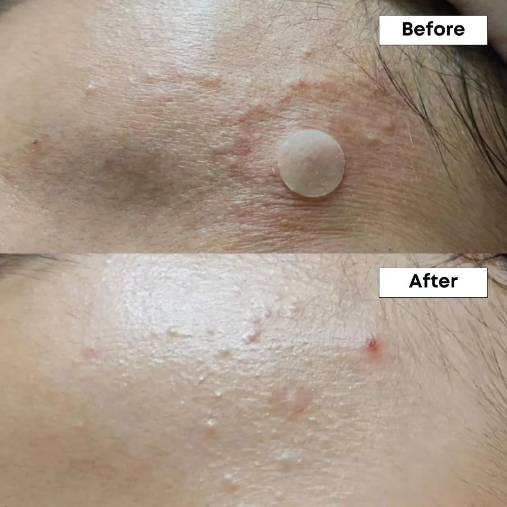 NINELESS A-Control 10% Azelaic Acid Serum - Image 4