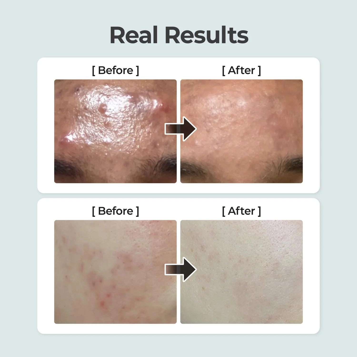 Numbuzin No.1 Pure-Full Calming Herb Toner - Image 4