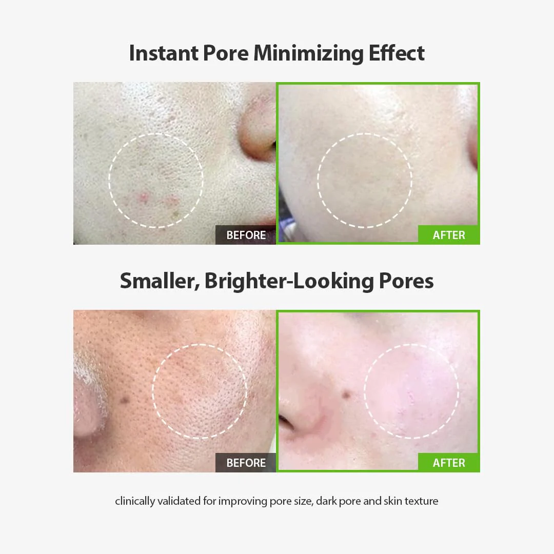 Sungboon Editor Green Tomato Pore Lifting Ampoule - Image 5