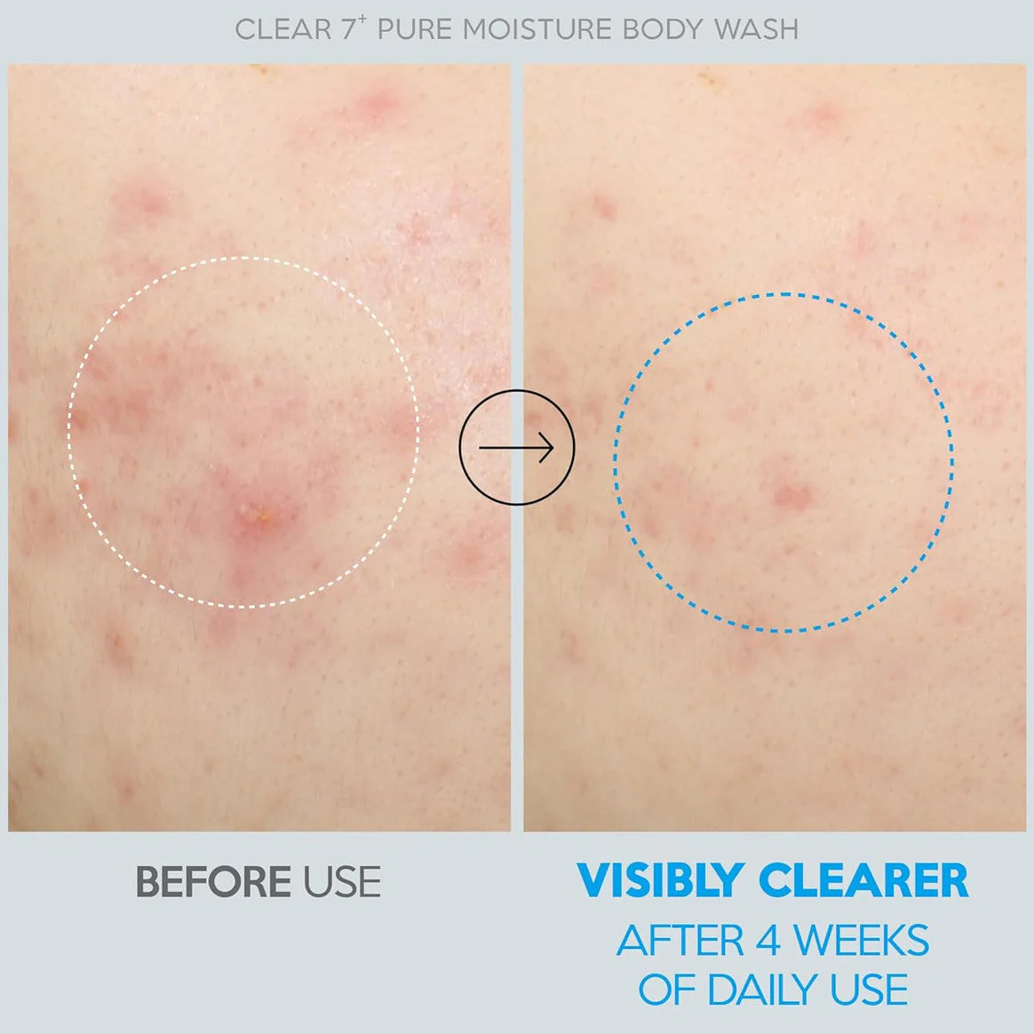 Troubless Clear 7 Plus Pure Moisture Body Wash - Image 3