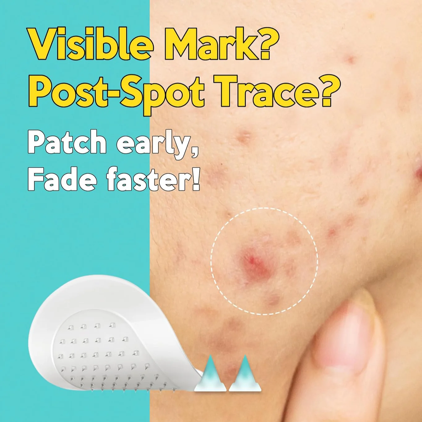 Troubless Micro-Point Patch Plus Vitamin C 10% For Dark Spot - Image 3