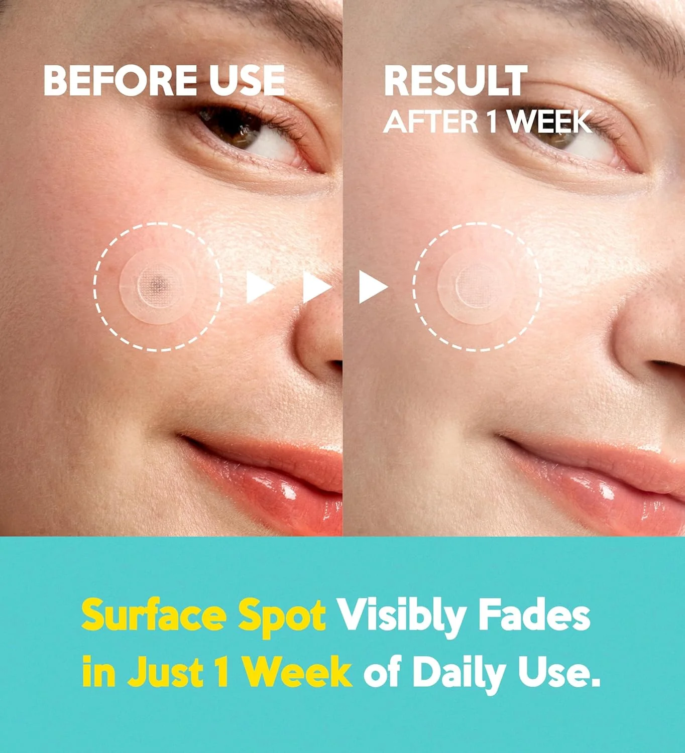 Troubless Micro-Point Patch Plus Vitamin C 10% For Dark Spot - Image 4