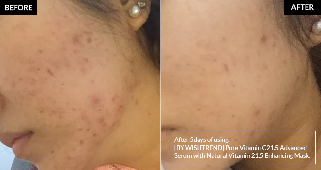 By Wishtrend Natural Vitamin 21.5 Enhancing Sheet Mask - Image 6